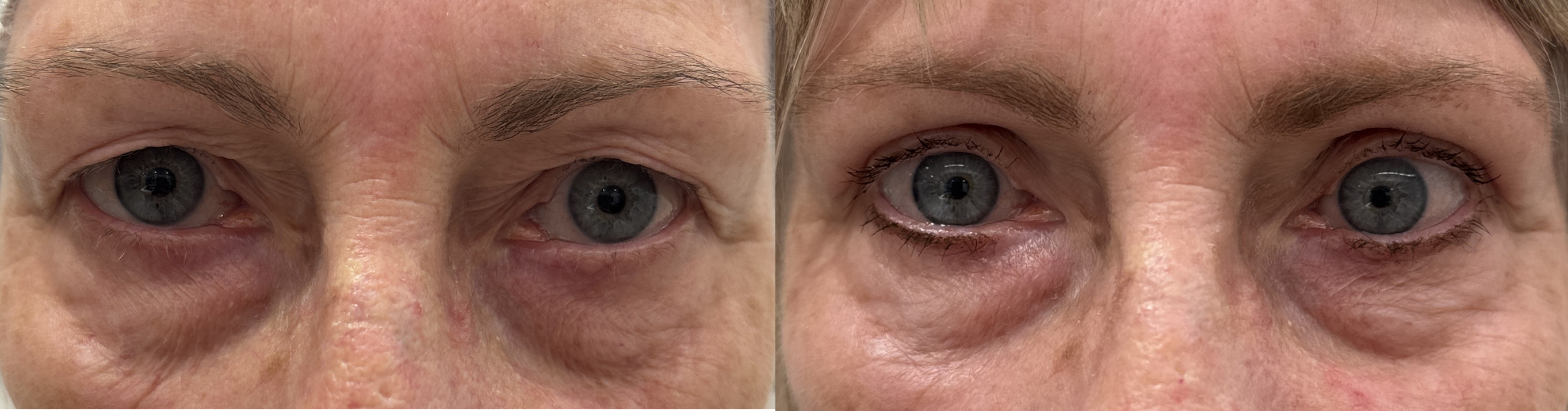 About Left Image