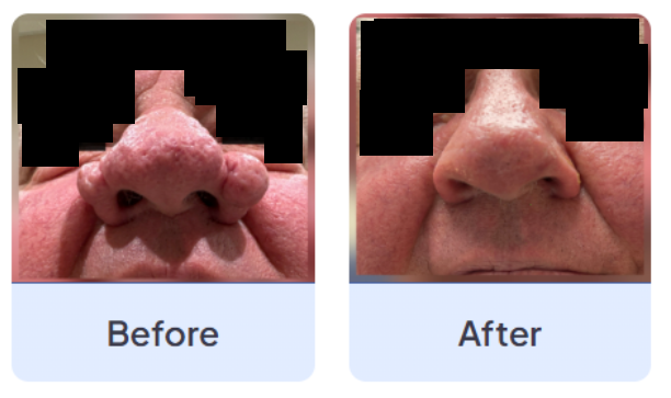 About Left Image
