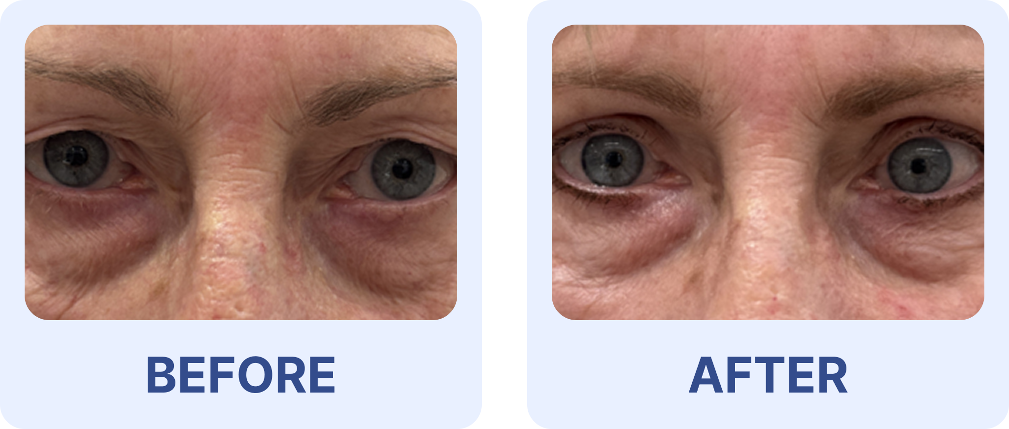 About Left Image