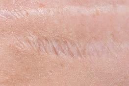 Choose Icon