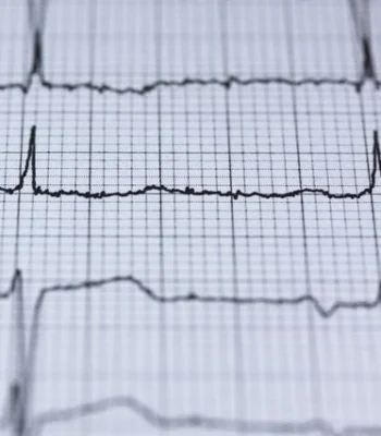 cardiovascular report