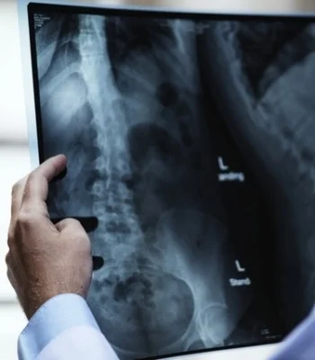 The Benefits of Massage for Ankylosing Spondylitis