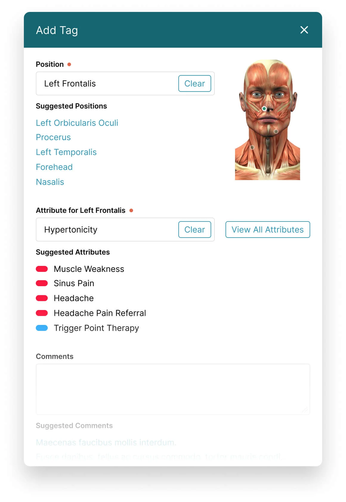 __wf_reserved_inherit
