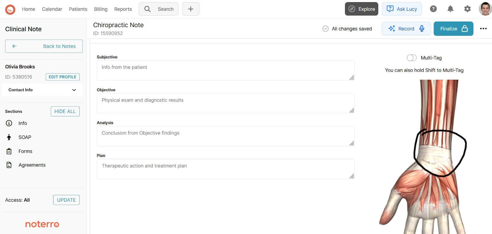 Chiropractic Clinical SOAP Note with Annotated Wrist Anatomy Diagram