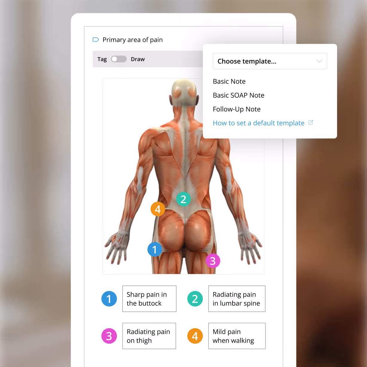 Diagram of human back muscles with numbered dots showing pain areas: buttock, lumbar spine, thigh, and mild pain walking.
