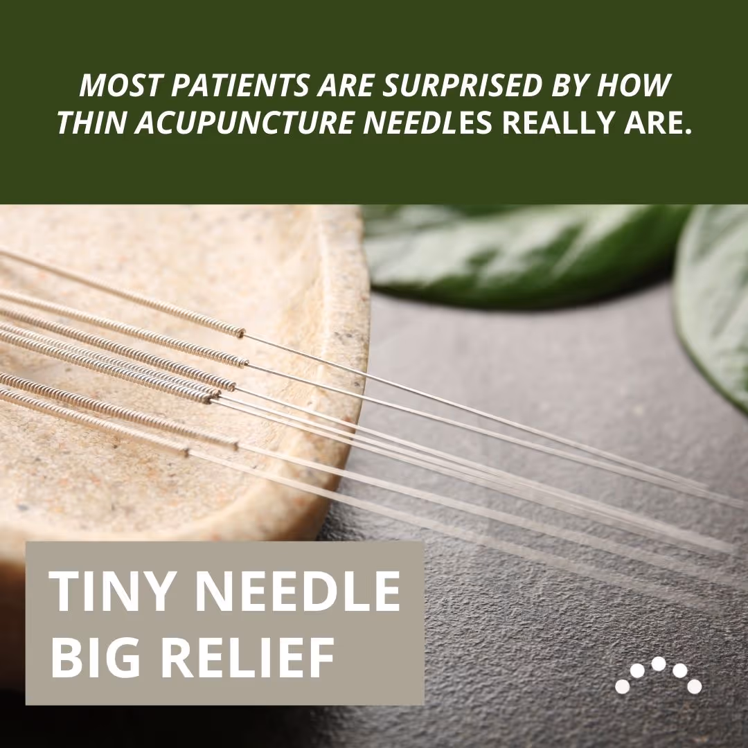 Does Acupuncture Hurt? Tips To Set Client Expectations