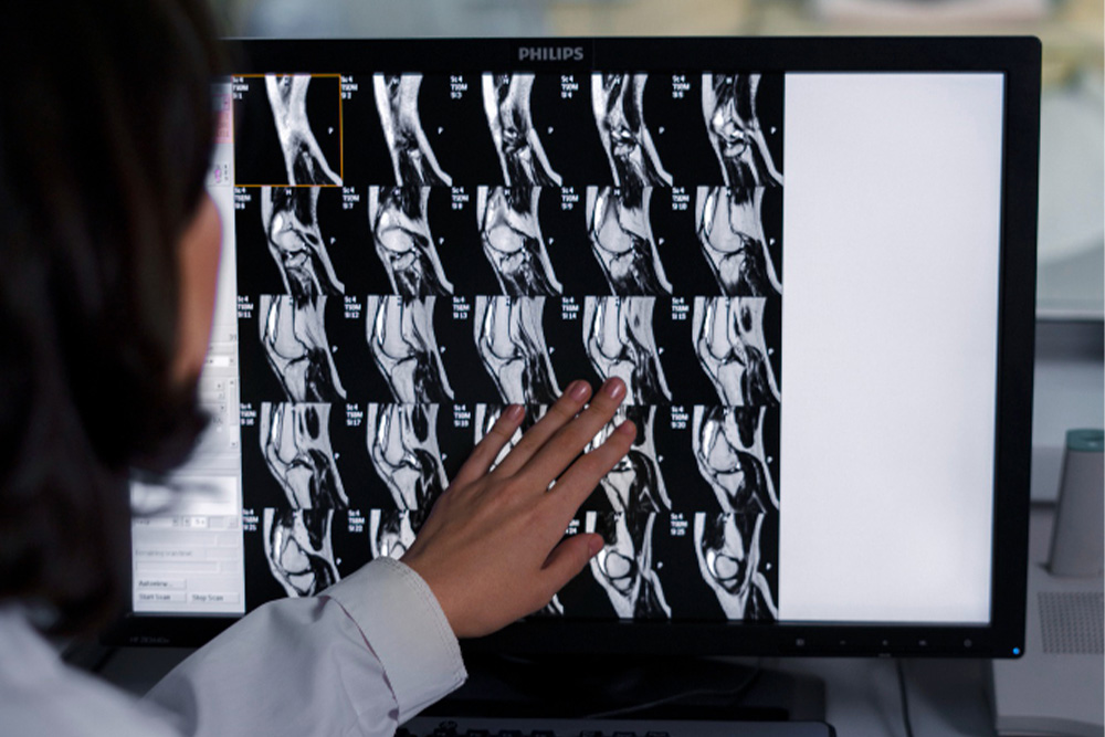 فحص كثافة العظام (DEXA)