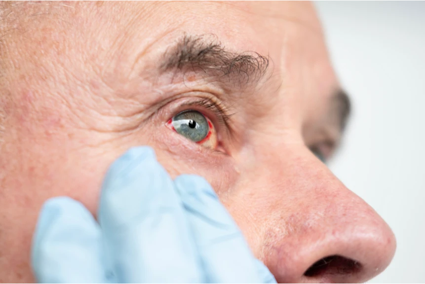 Wat moet je doen als je iets in je oog hebt?