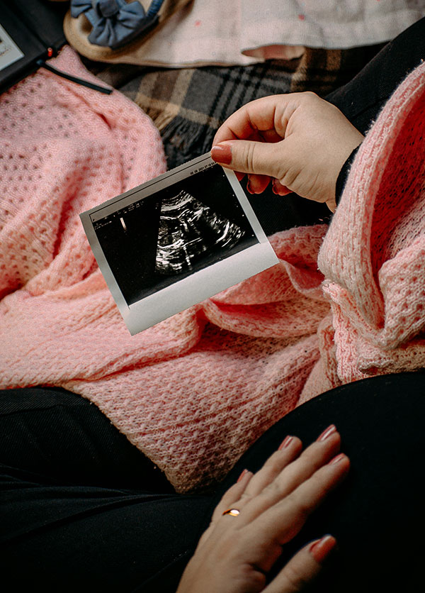 Pregnant woman holding ultrasound photo