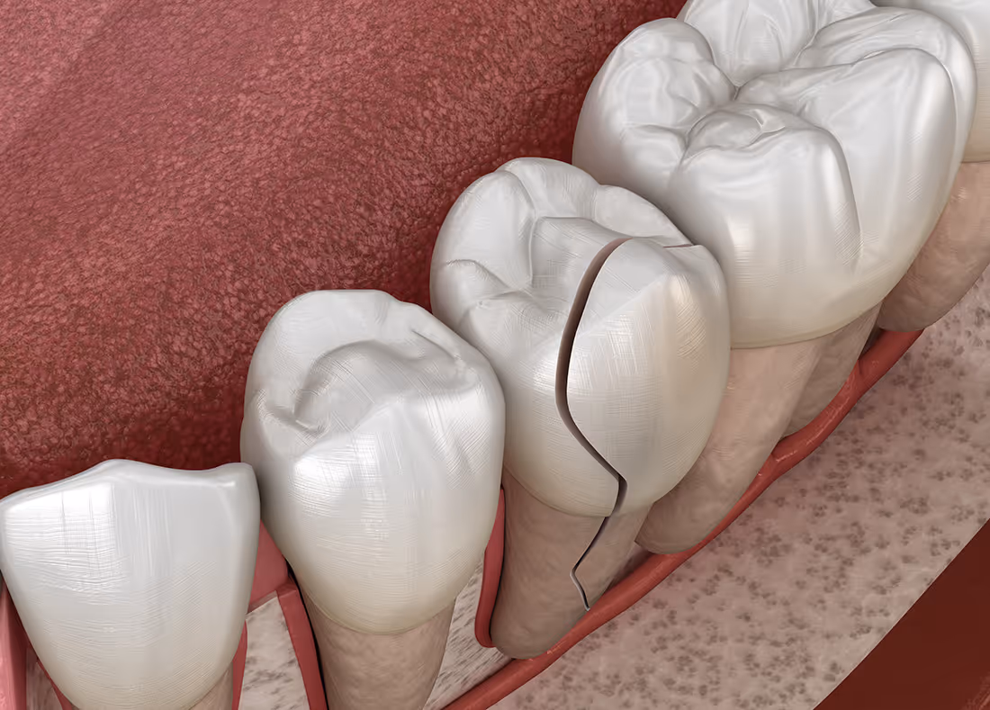 Greensboro emergency dentist