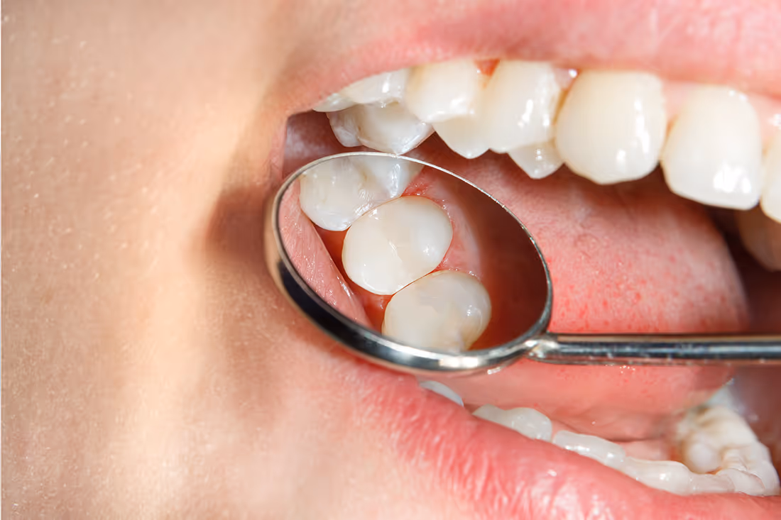 Greensboro restorative dentistry