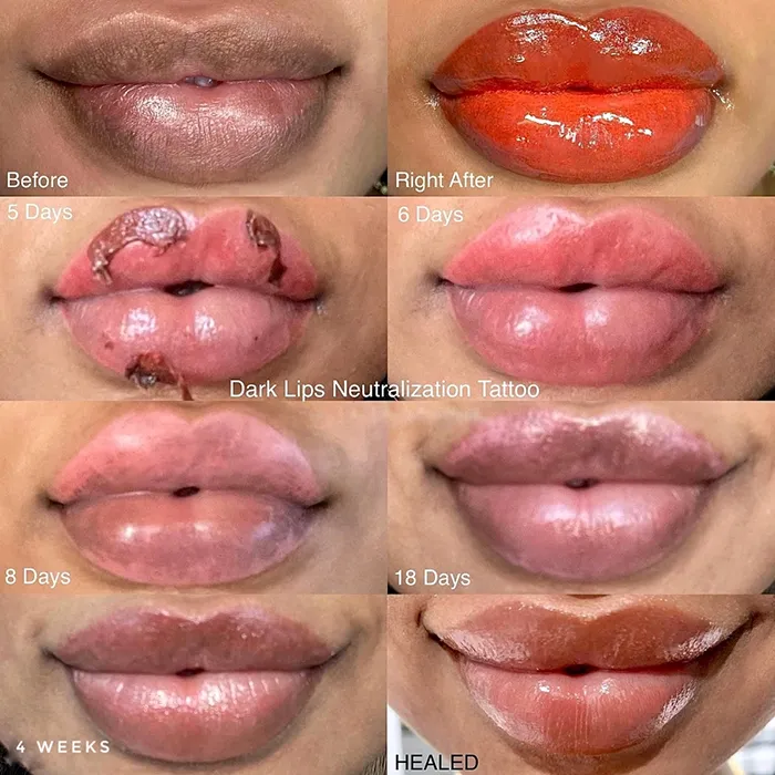 Dark lip neutralization results at Re:Pigment.Me Sterling VA