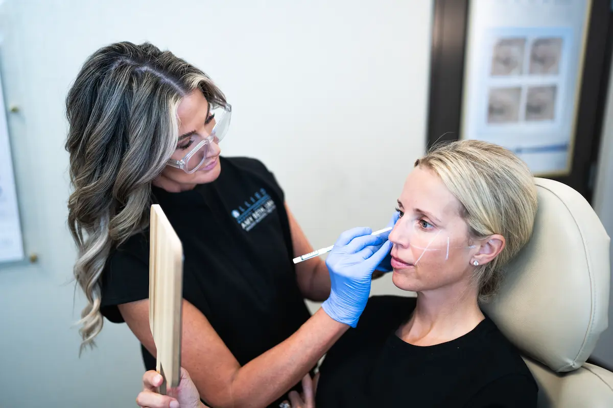 Dermal Filler (Juvéderm® Collection of Fillers) at Allied Medical Aesthetics in Westminster, CO