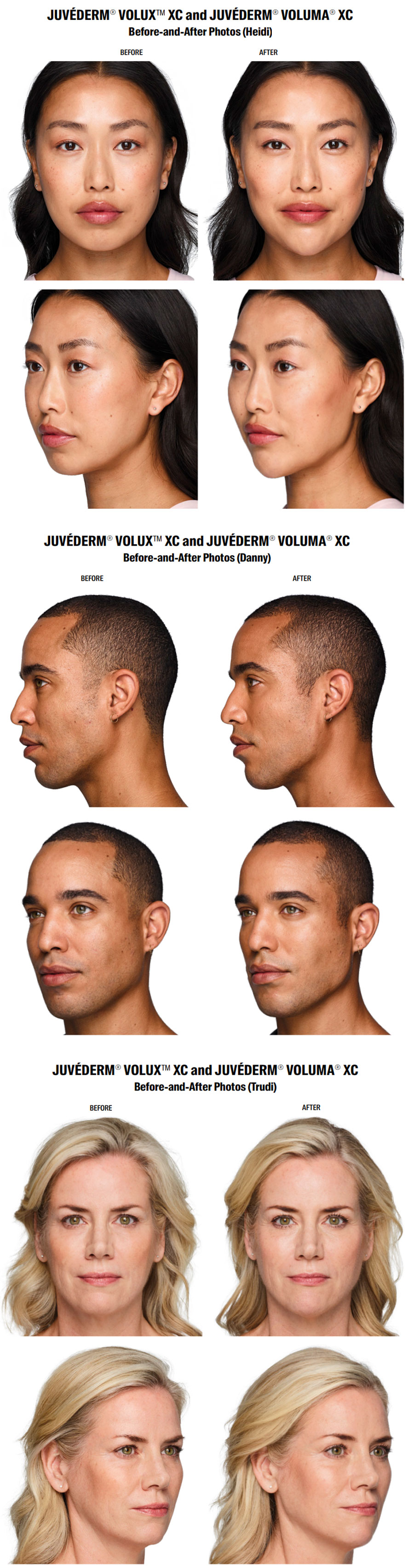 Lux Medical Spa Treatments