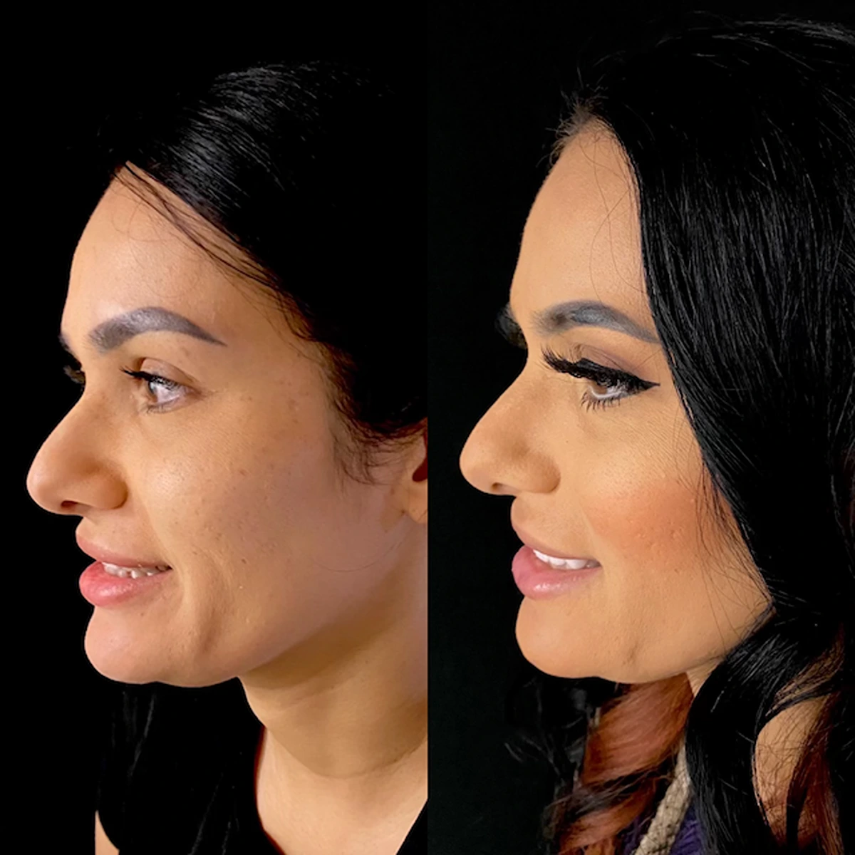 Diquattro Before and After