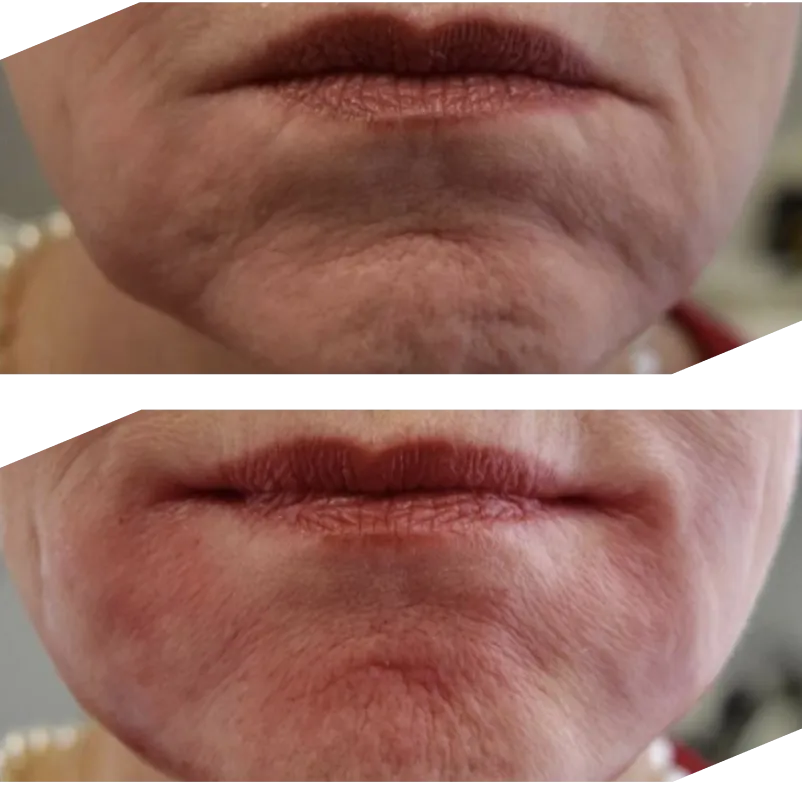 Real patient results