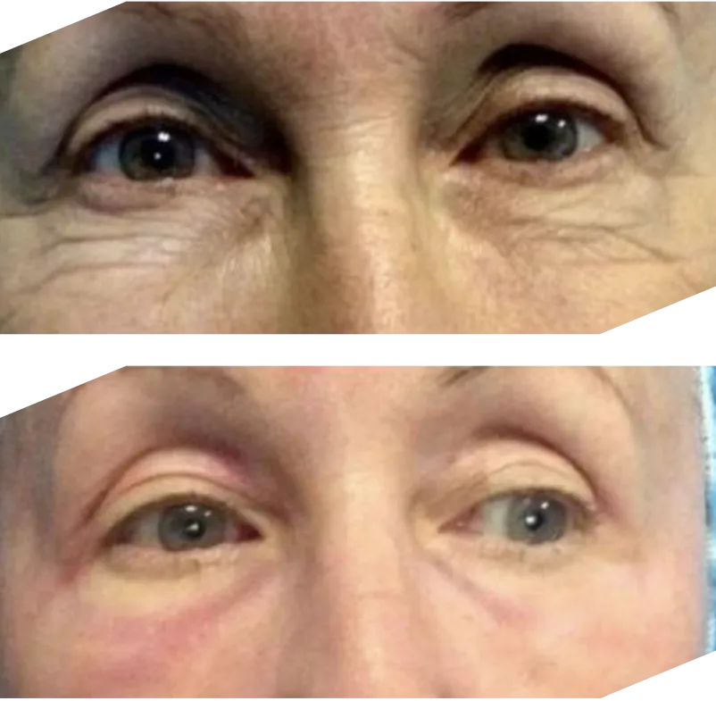 Real patient results
