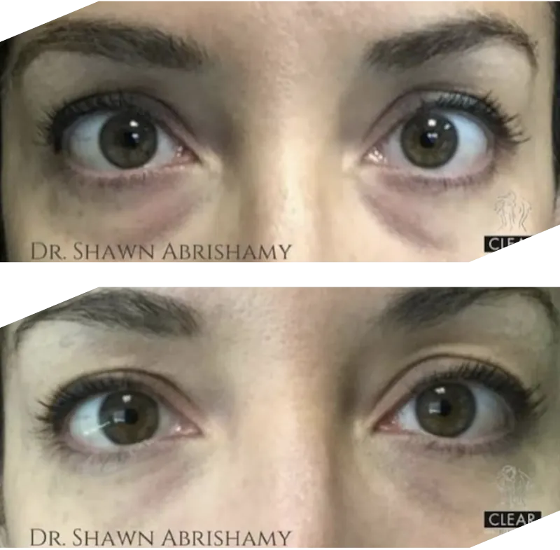 Real patient results