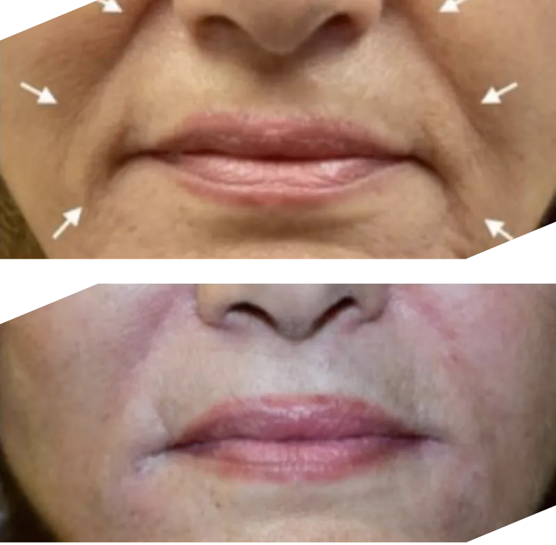 Real patient results