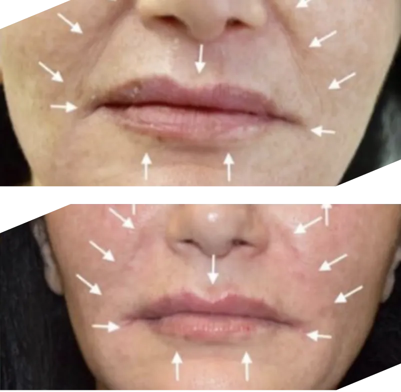 Real patient results