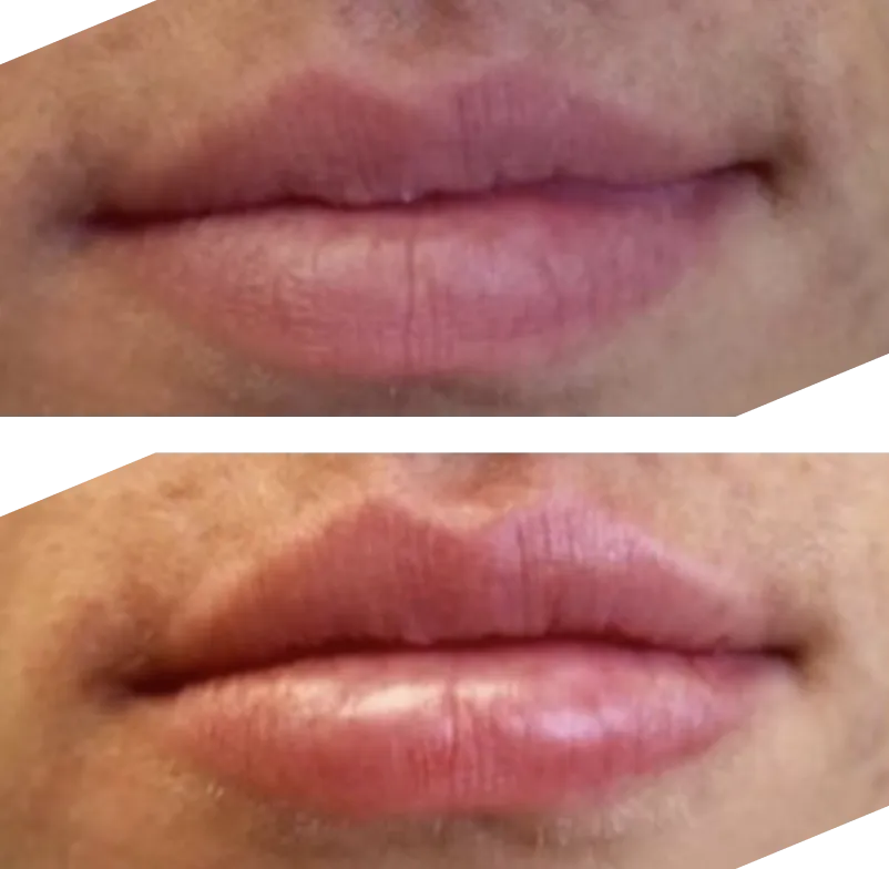 Real patient results