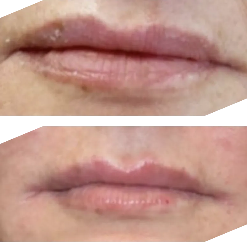 Real patient results