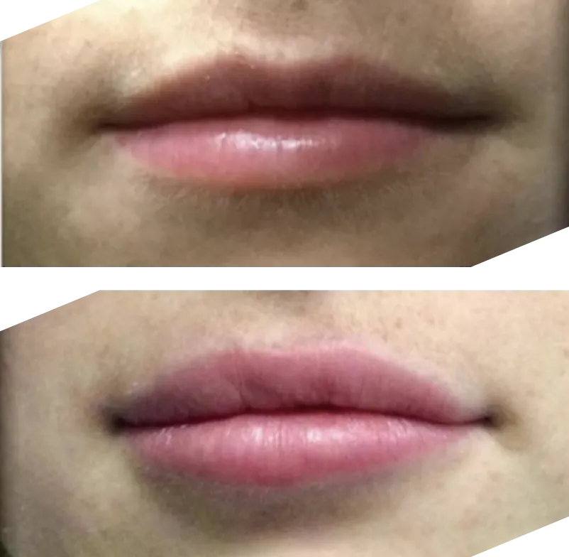 Real patient results