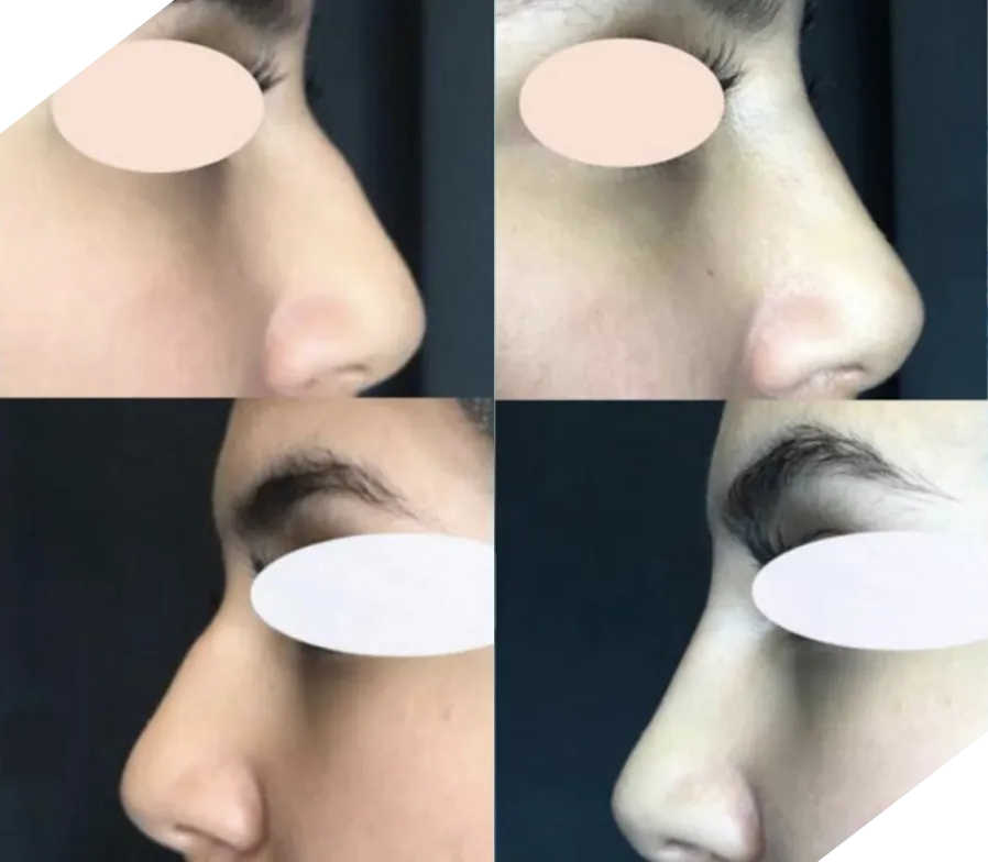 Real patient results