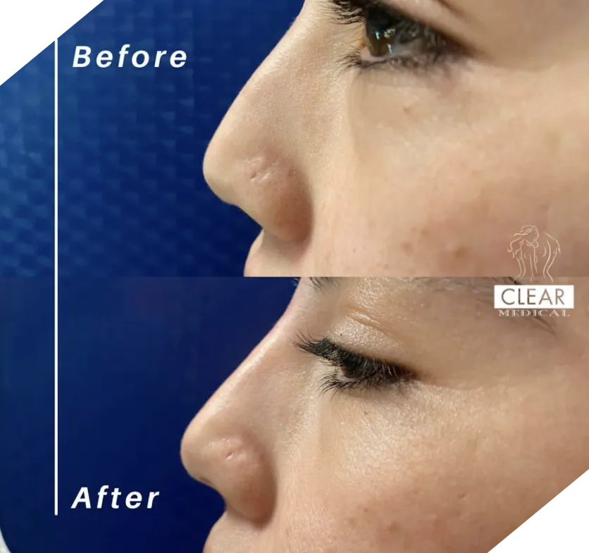 Real patient results