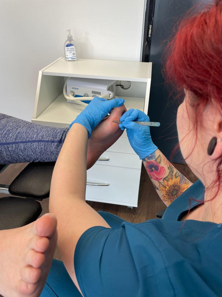 Romy removing hard skin from a patients foot