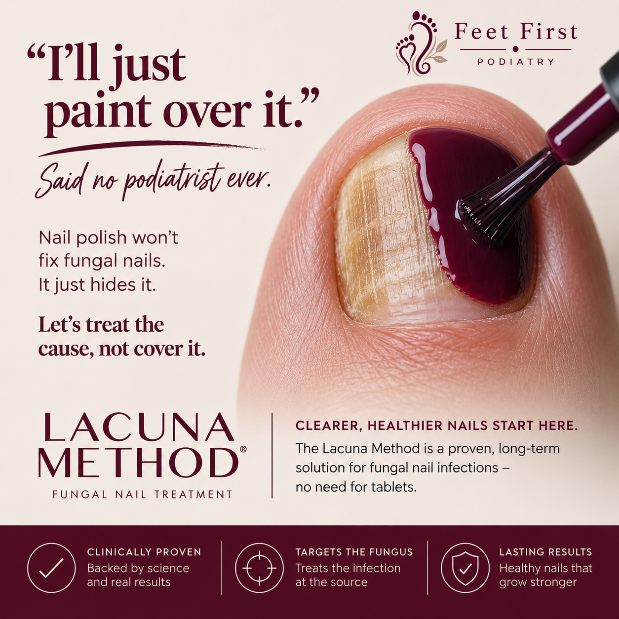  close-up photograph of a big toe with a thickened, discoloured toenail showing signs of fungal nail infection - the nail appears yellow-brown, ridged, and opaque. A teal nail polish brush is being applied over the damaged nail, illustrating the ineffectiveness of painting over the problem. Overlaid text reads: "I'll just paint over it." Said no podiatrist ever. Nail polish won't fix fungal nails. It just hides it. Let's treat the cause, not cover it." Below the image is the Lacuna Method® Fungal Nail Treatment logo alongside the text: "Clearer, healthier nails start here. The Lacuna Method is a proven, long-term solution for fungal nail infections - no need for tablets." Three benefit icons at the bottom read: Clinically Proven - backed by science and real results; Targets the Fungus - treats the infection at the source; Lasting Results - healthy nails that grow stronger.