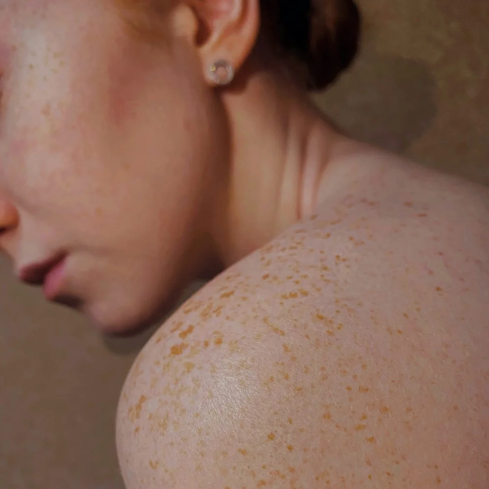 Косметика с пробиотиками для кожи: мода или реальное восстановление микробиома