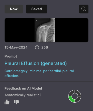 The generation history with a single feedback question and a progress ring