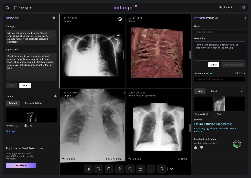Four images in a two by two split, comparing original scans with a generated one