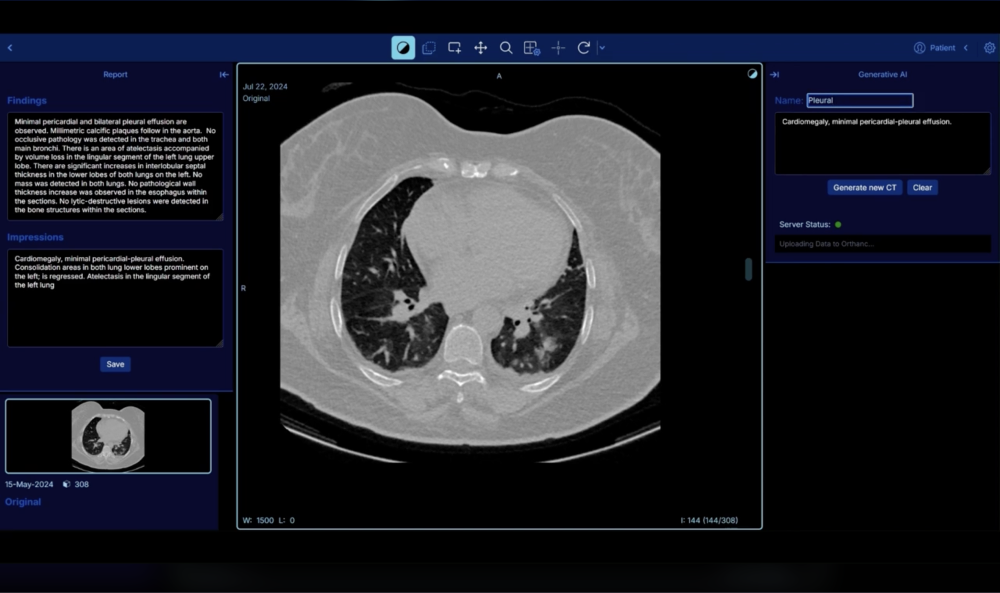 The existing viewer, with the toolbar in the top bar and navy report and generative AI panels