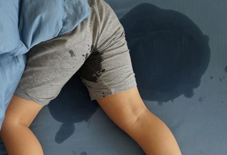 Xuất tinh khi ngủ khiến nam giới thấy tinh dịch khi thức dậy