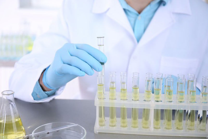 Xét nghiệm nước tiểu giúp phát hiện tình trạng bất thường của tinh trùng