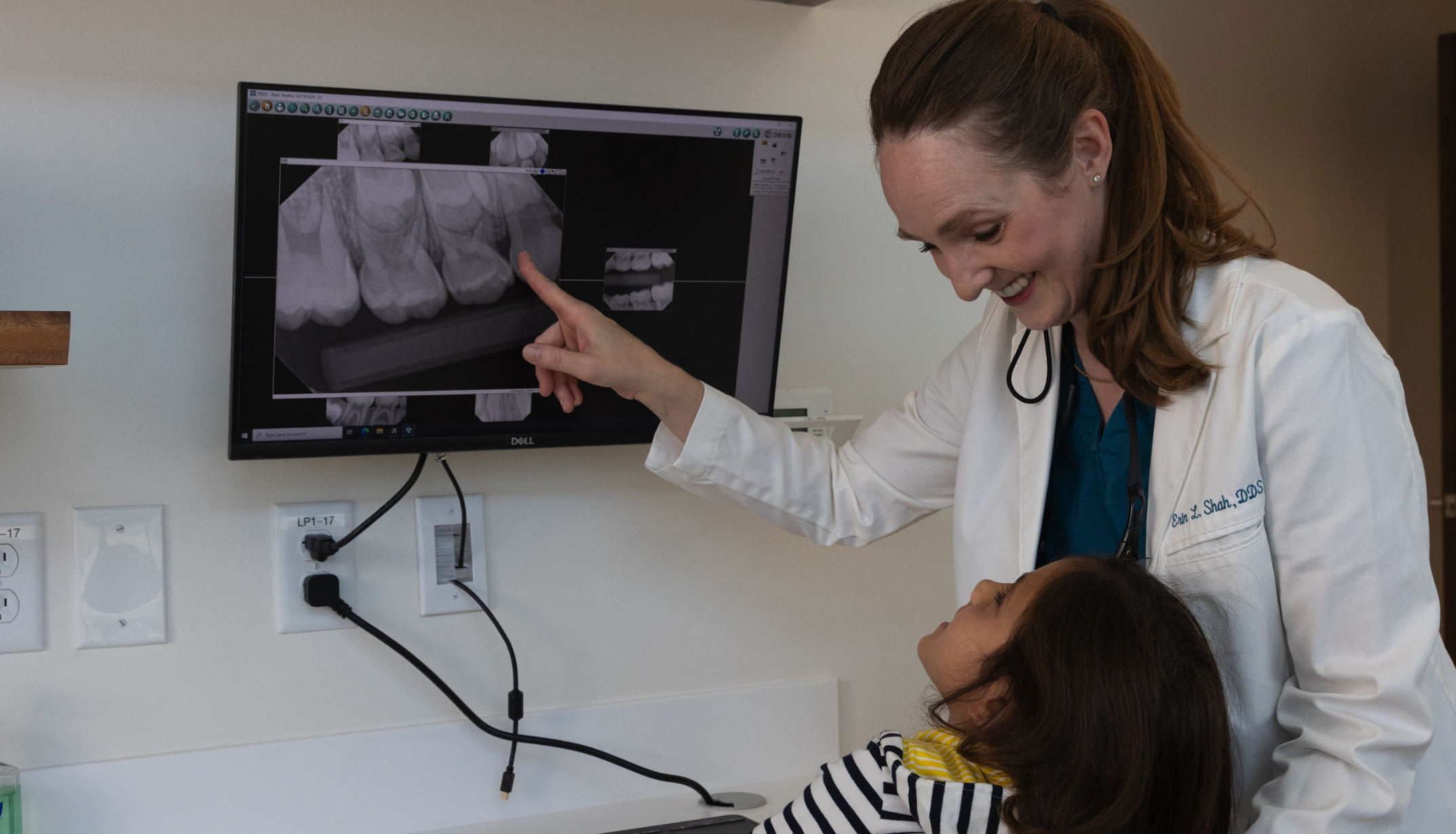 dental sealants