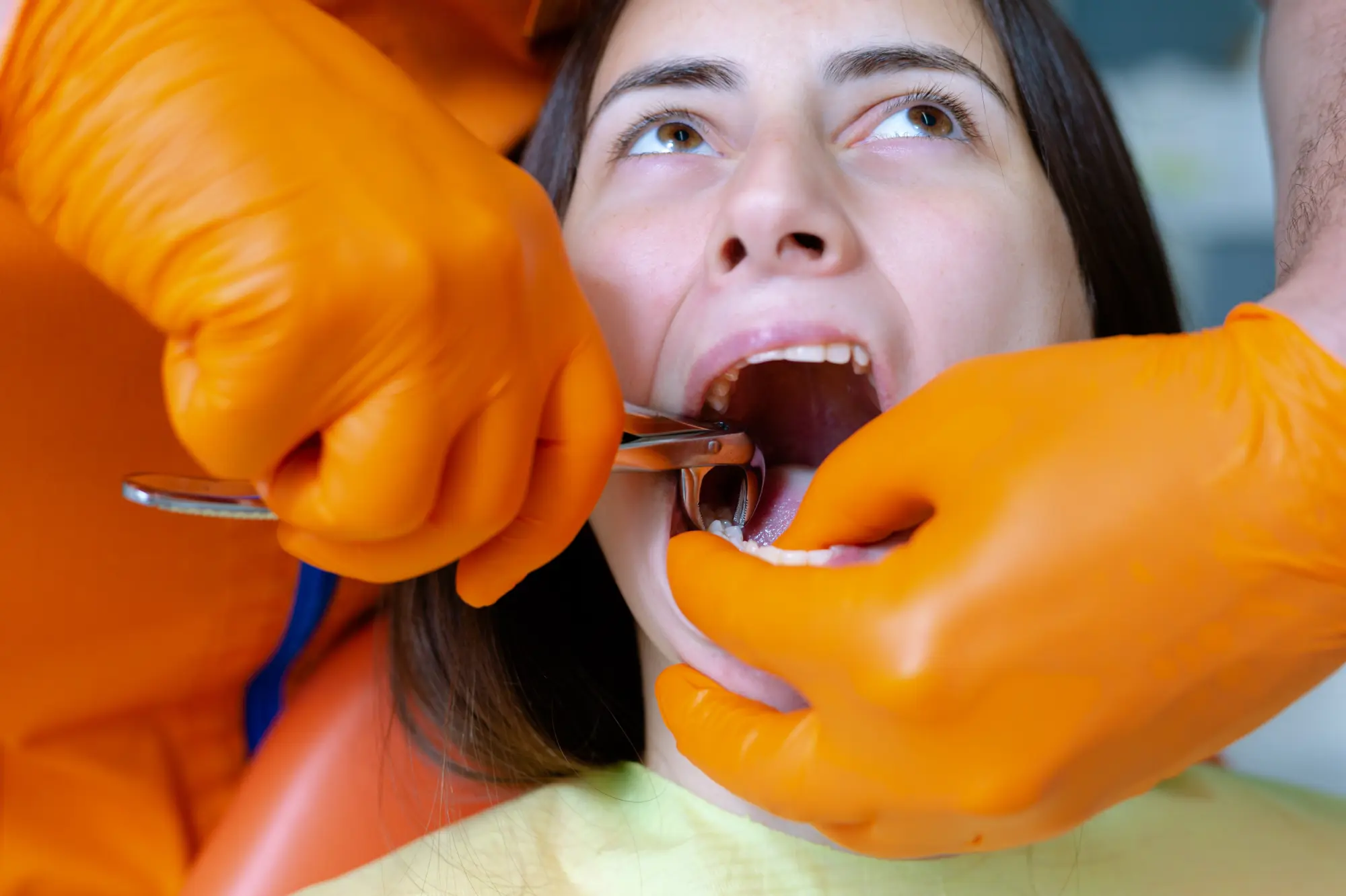 dental sealants