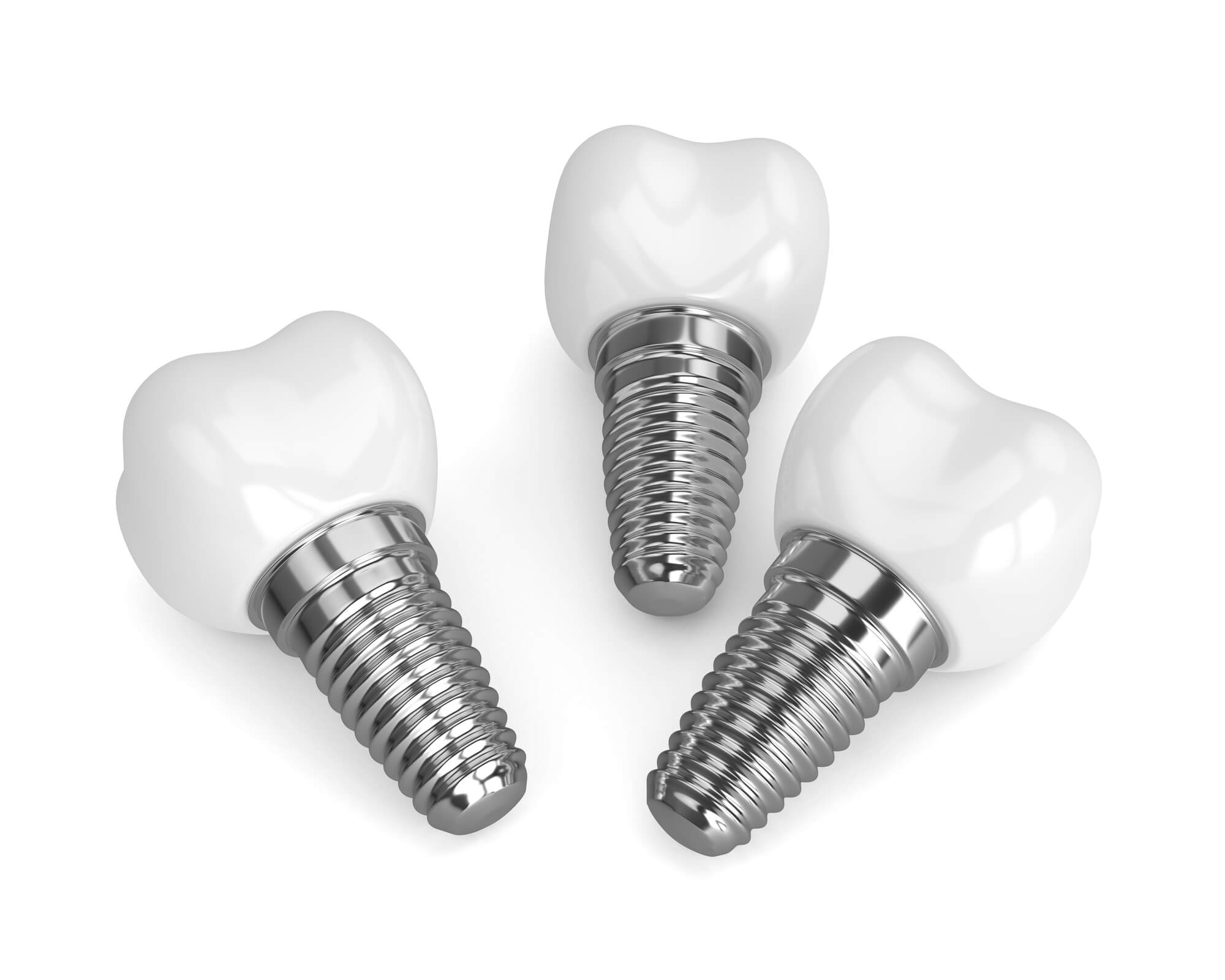 3D render of Dental Implants Pompano Beach