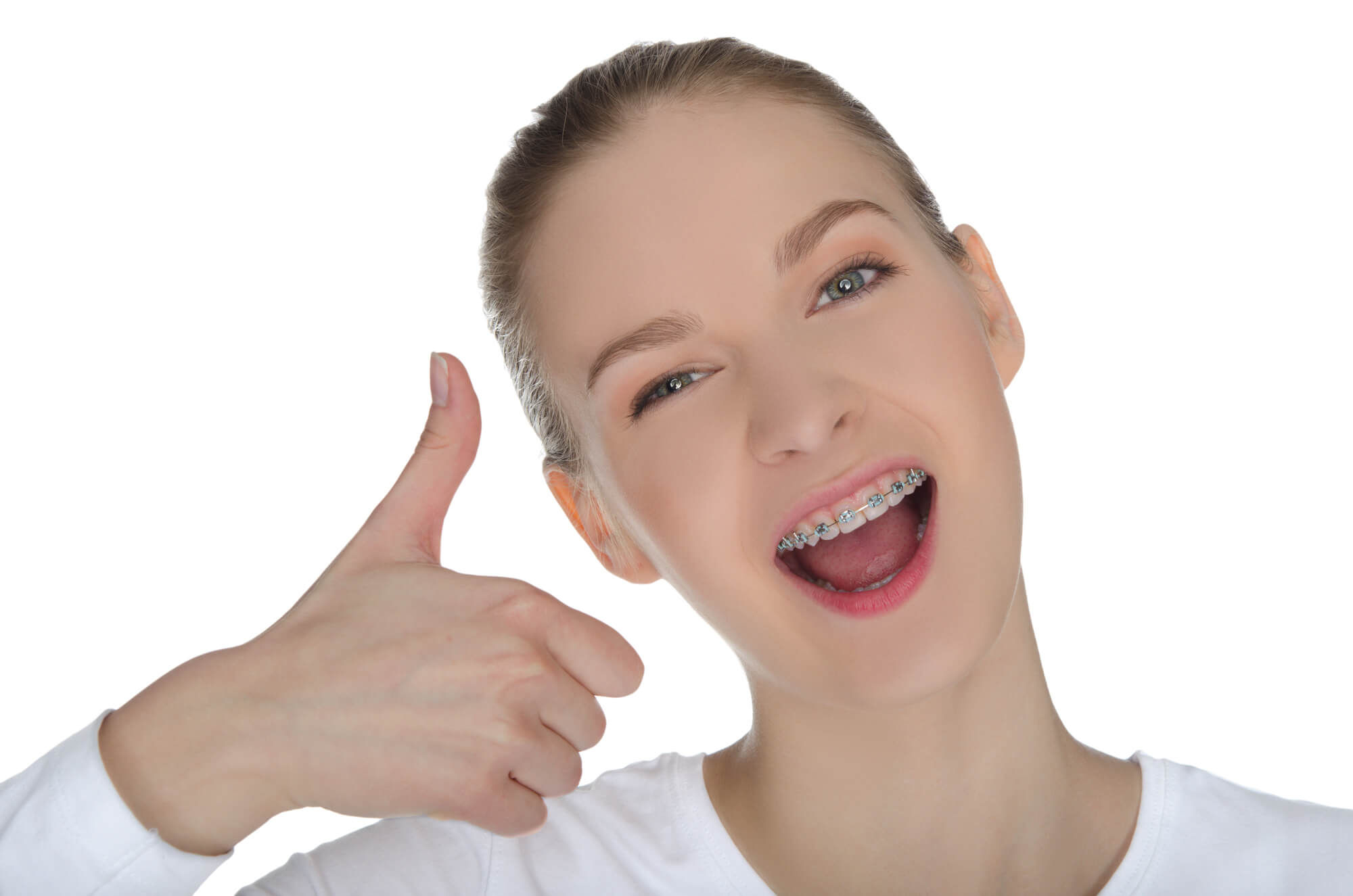 woman wearing Braces Pompano Beach giving the thumbs up