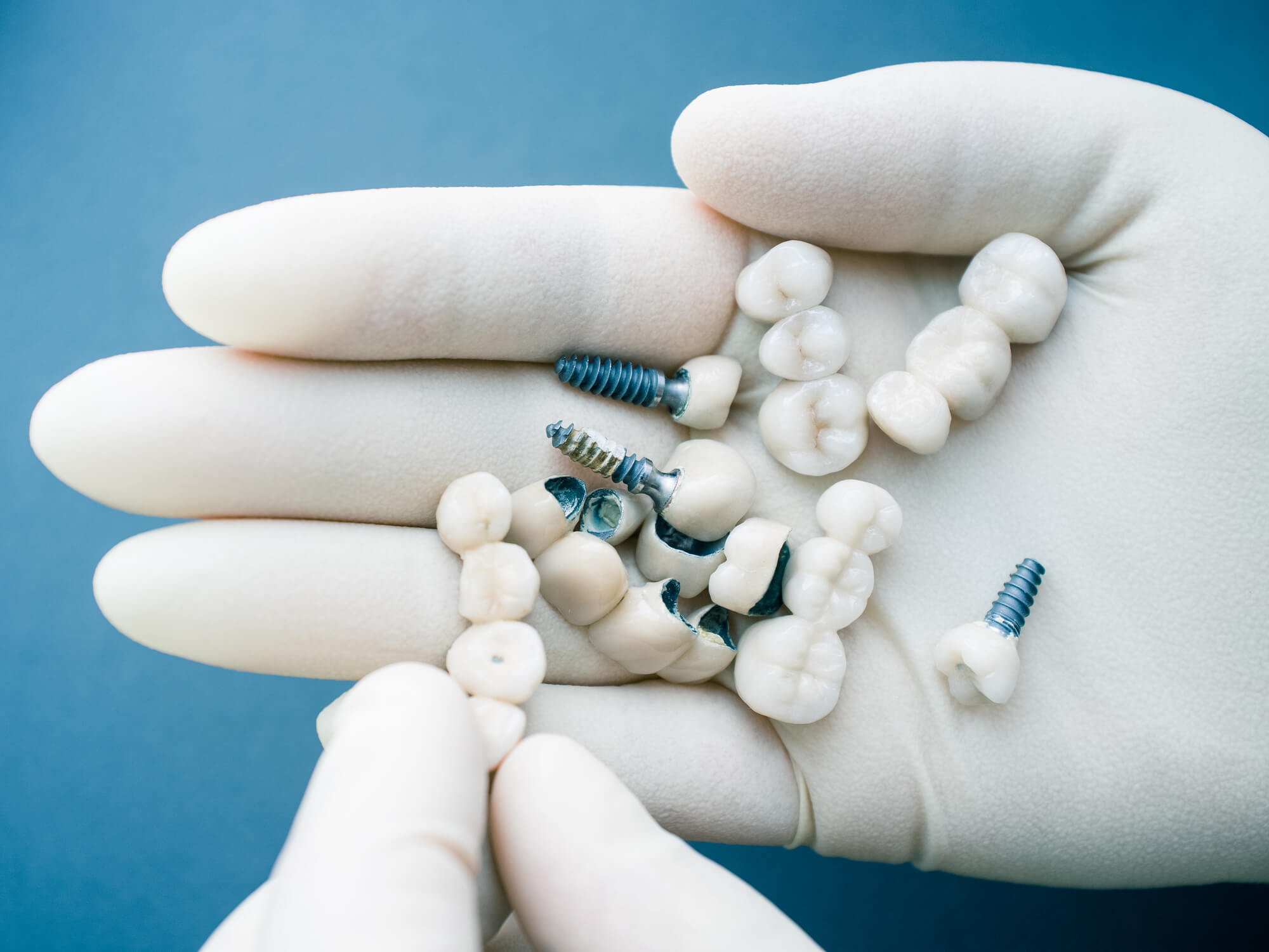 different dental implants in 33062
