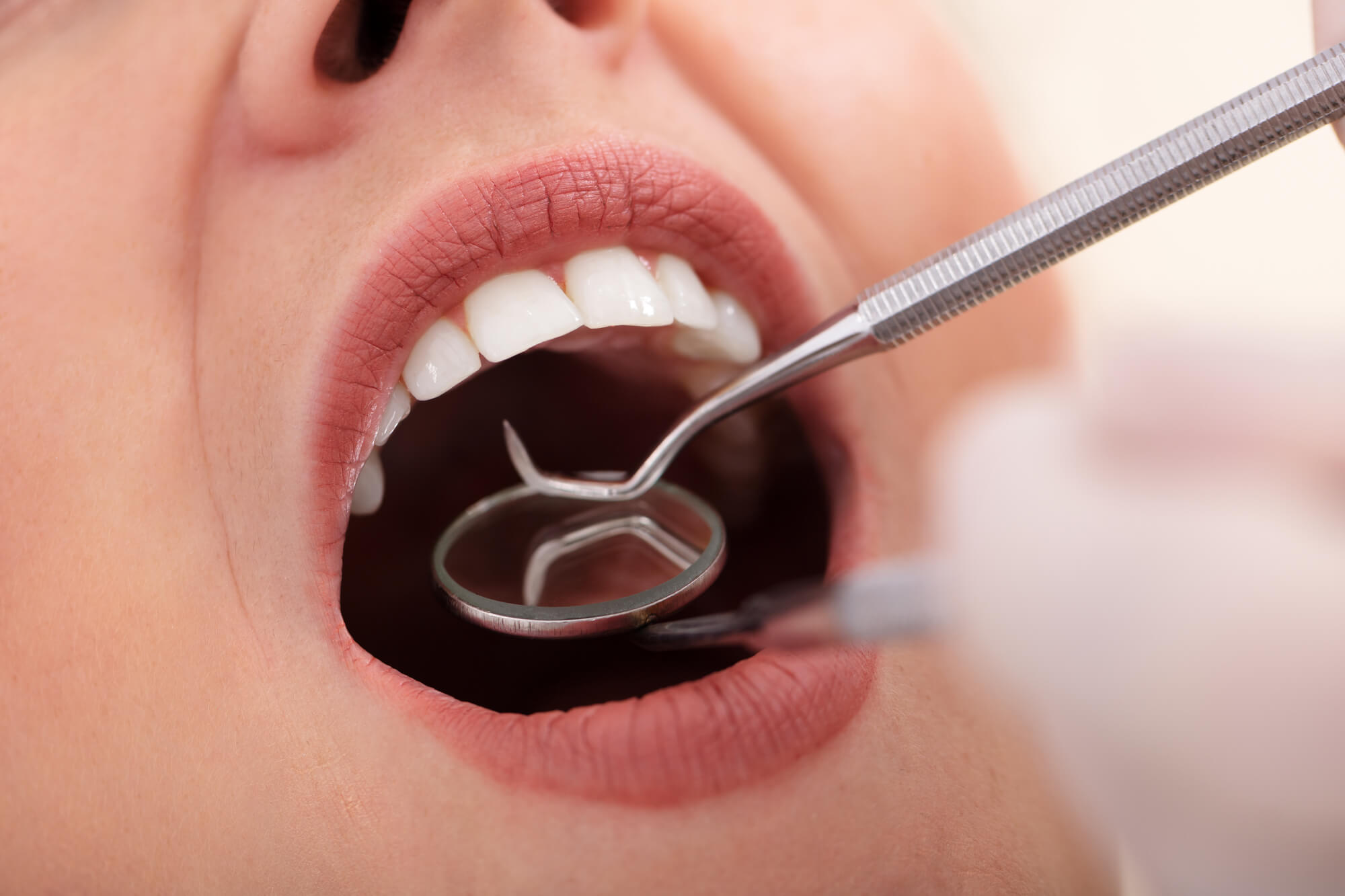 Cosmetic Dentist in Pompano Beach with Dental Mirror