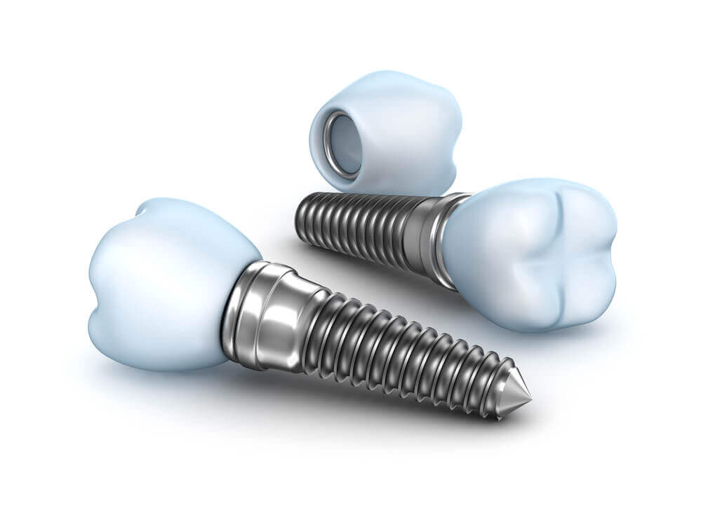 two pieces of Dental Implants in 33062