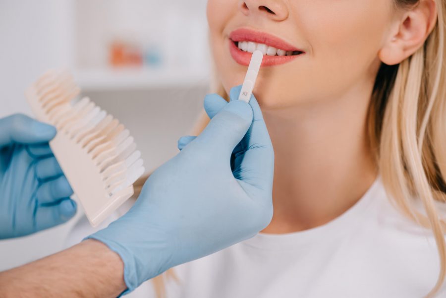 illustration of Teeth Whitening in Pompano Beach