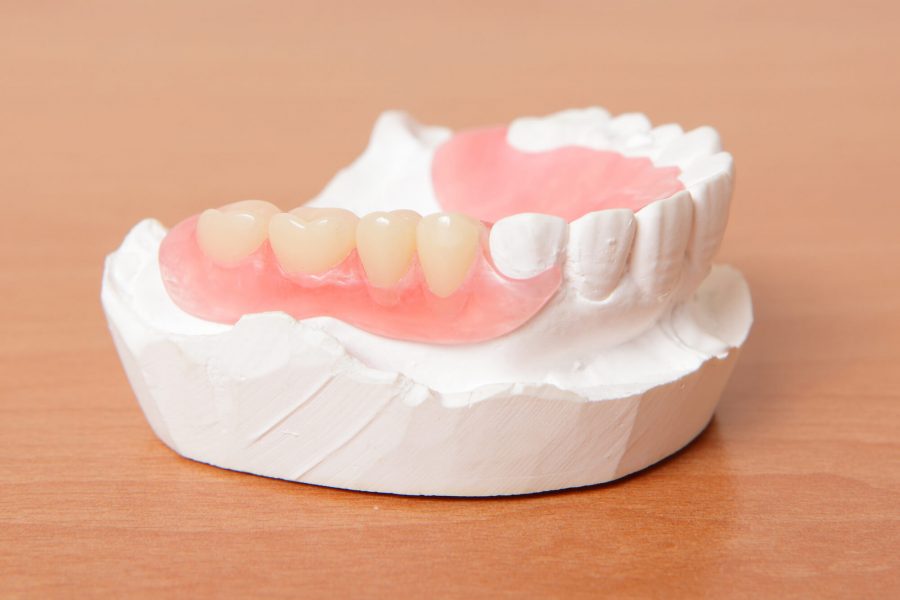 Illustration of Dentures in Pompano Beach