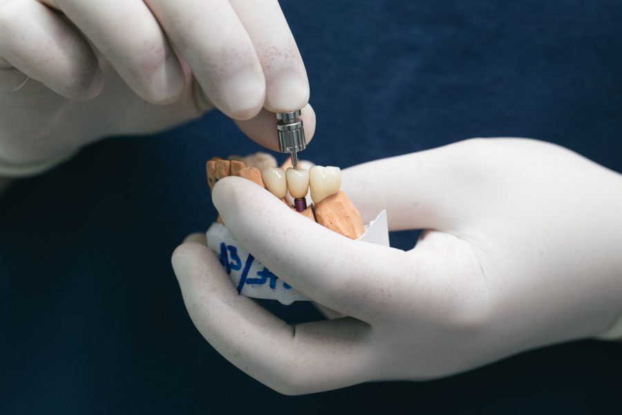 plaster of Dental Implants in Pompano Beach