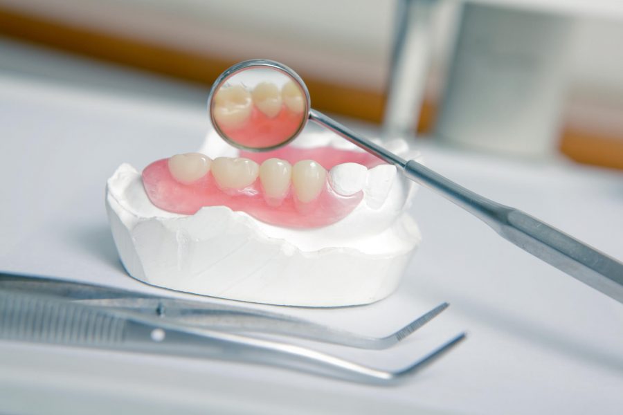 illustration of Dentures Pompano Beach