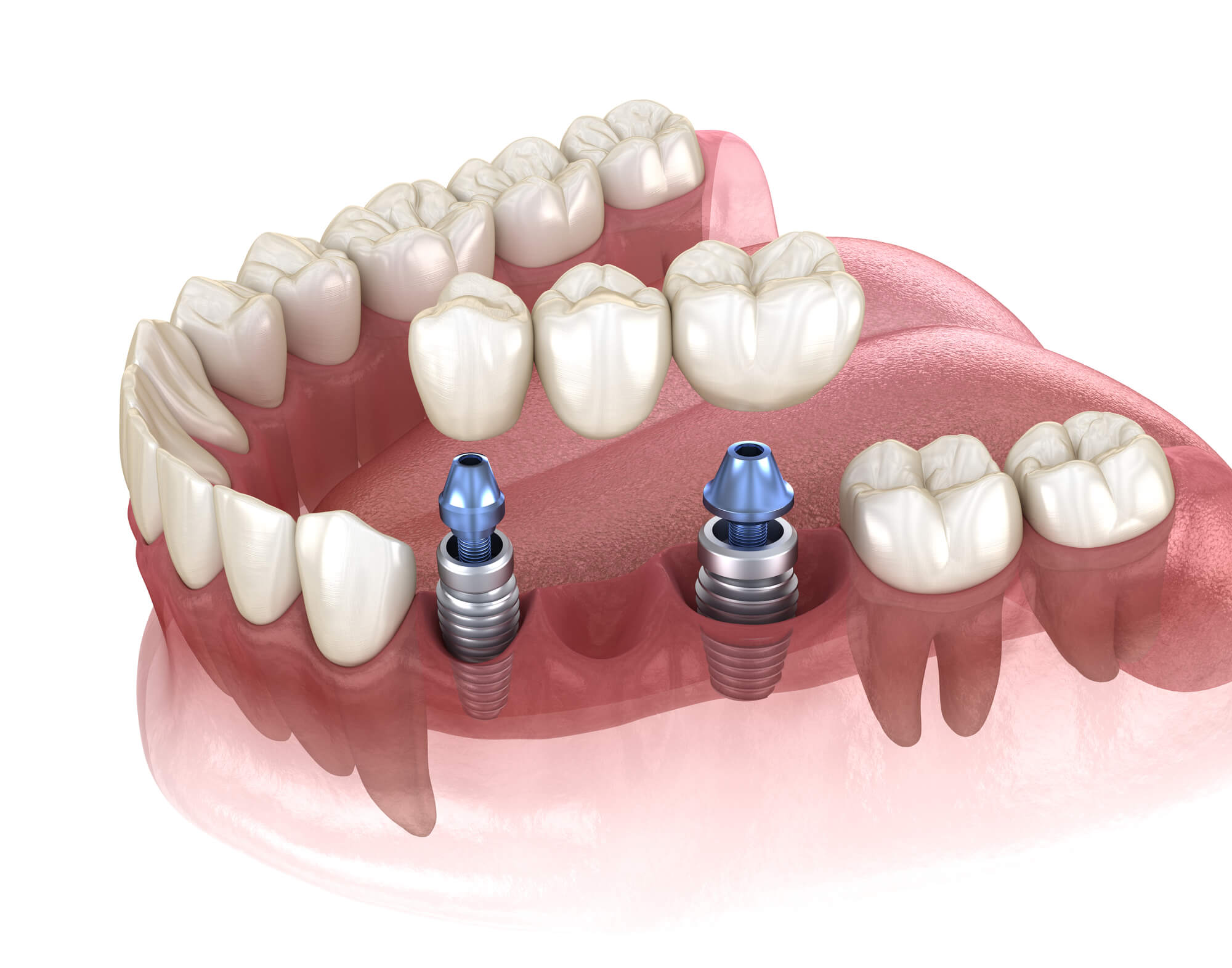 Dentist 33062
