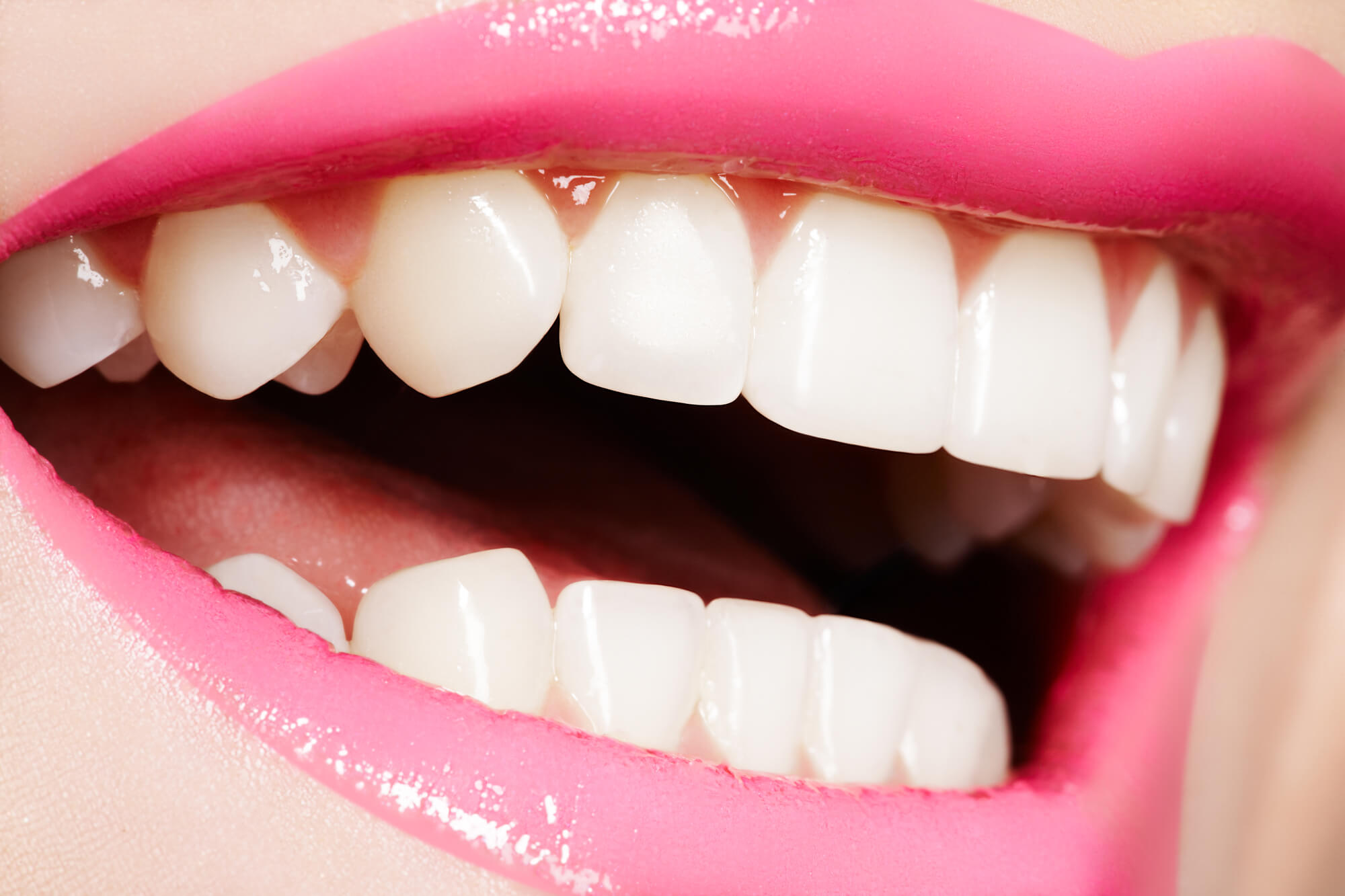 woman showing her smile after visiting her cosmetic dentist in pompano beach